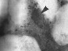 Figure VI. Inclusion body (arrow) in liver cell due to infectious canine hepatitis magnified 2,400 times.